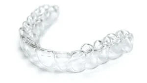 Invisalign closeup, Smile Ranch Orthodontics